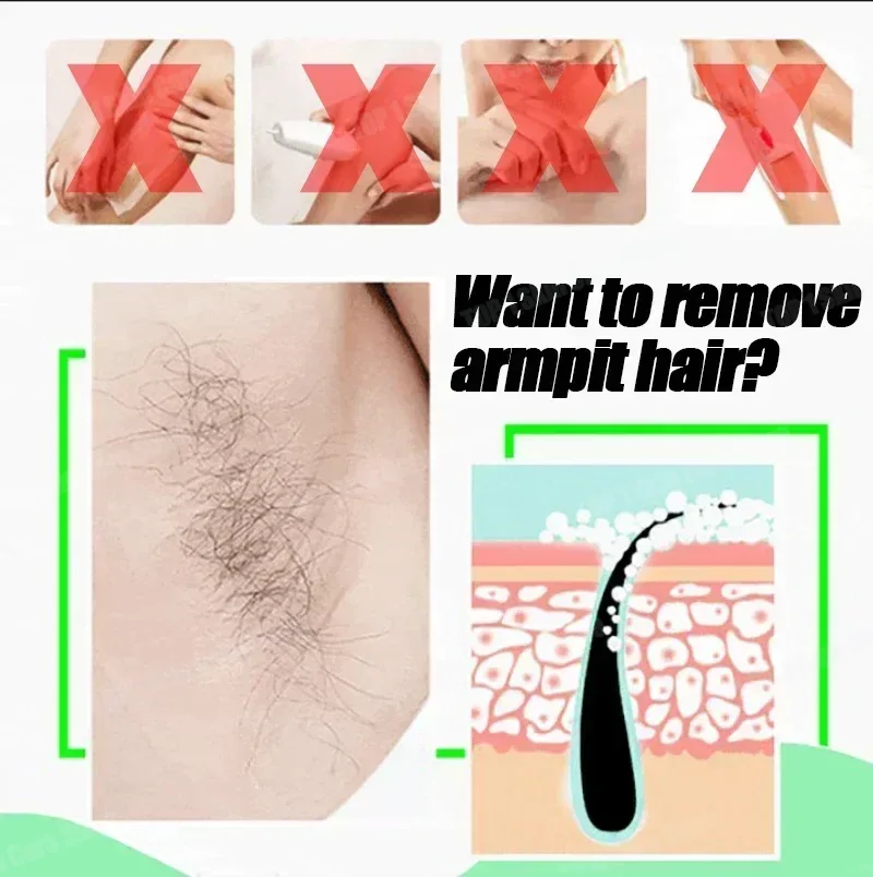 Haarentfernungsspray Kraftvoll – Hair Care Korea Bewertung und Preis